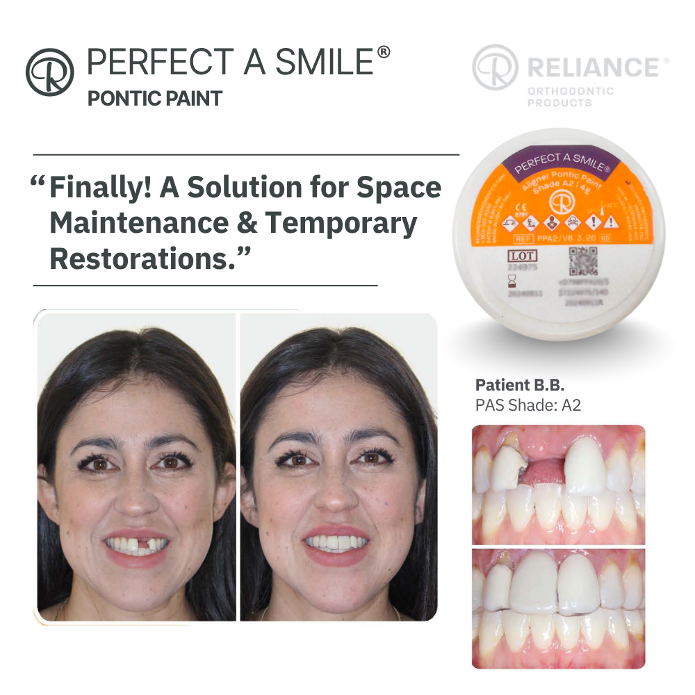 Perfect A Smile Pontic Paint - 2