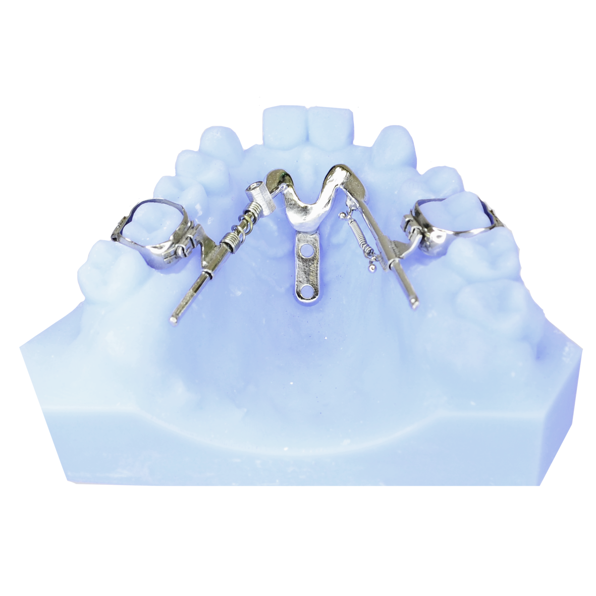 SD Slider fixed orthodontic appliance