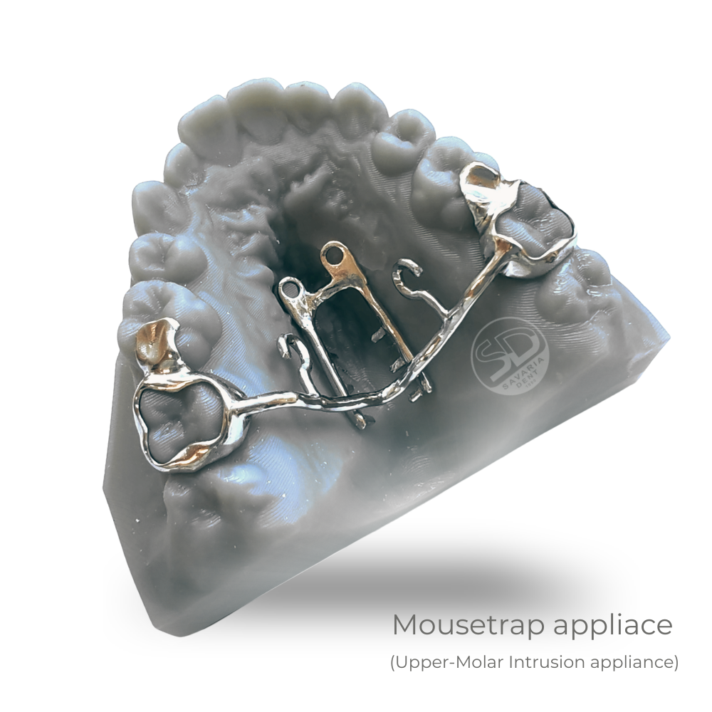Mousetrap - 1